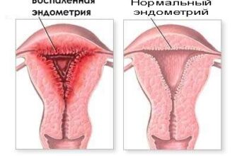 Вагітність після лікування хронічного ендометриту: можливості та поради