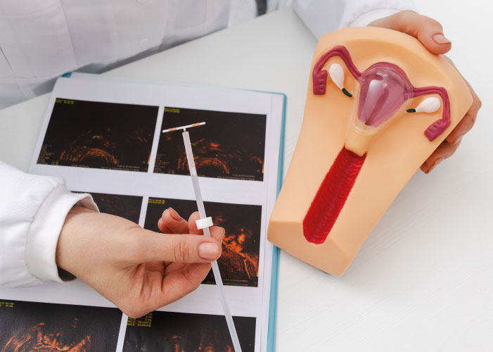 Установка внутрішньоматкової спіралі в м. Київ - Євмакс Київ ...