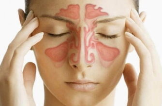 Відгуки після видалення кісти гайморової пазухи: досвід пацієнтів