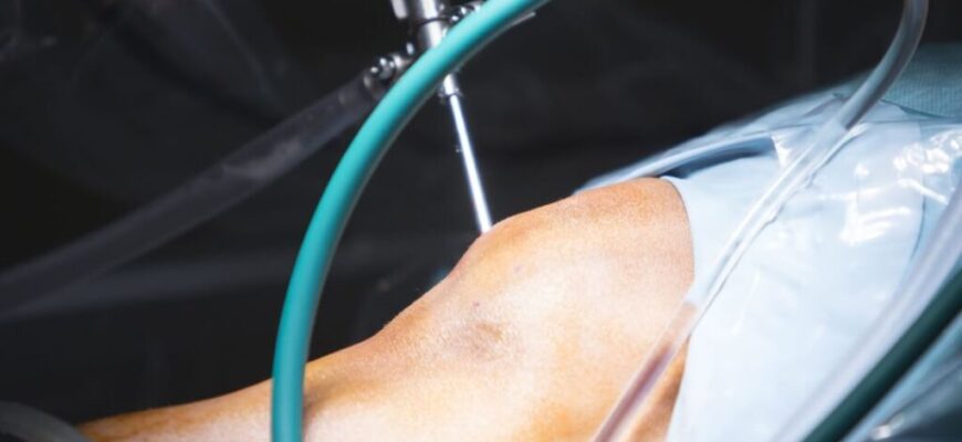 Відновлення і реабілітація після артроскопії коліна: ефективні методи