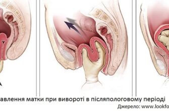 Відновлення матки після пологів: важливі етапи та рекомендації