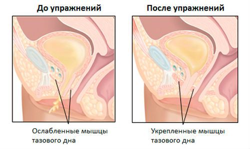 Часте сечовипускання після пологів і інші проблеми з ним