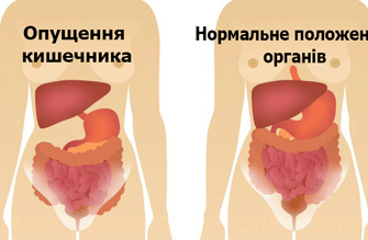 Вісцеральний біль: причини, симптоми та ефективні методи лікування
