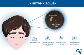 Воші: Як Заражаються і Звідки Вони Беруться – Основні Причини та Шляхи