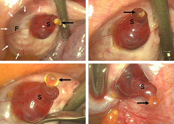 Виділення після овуляції: ознаки можливого зачаття та їх значення