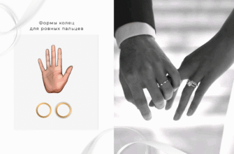 Як безпечно і швидко зняти обручку з набряклого пальця: поради