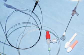 Як безпечно зняти катетер з сечового міхура: покрокова інструкція