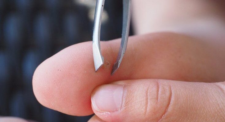 Як безпечно зняти кільце, коли палець набряк: поради та методи