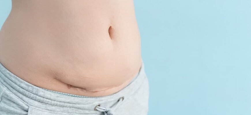 Як дізнатися, що розійшлися шви після операції: симптоми та поради