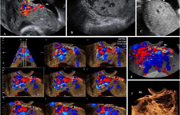 Як доглядати та зменшити рубець після кесаревого розтину