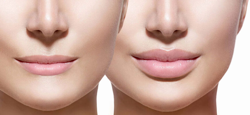 Як доглядати за губами після збільшення: ефективні засоби для відновлення Як доглядати за губами після збільшення: ефективні засоби для відновлення