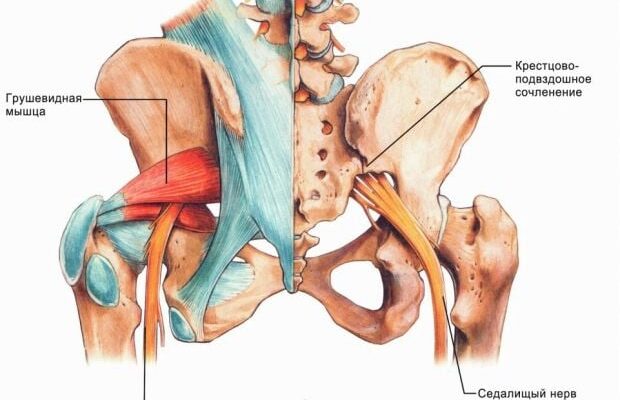 Як ефективно лікувати запалення сідничного нерва: дієві методи та поради