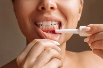 Як ефективно обробляти рани в роті: найкращі засоби та рекомендації