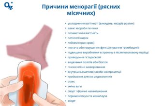 Як ефективно підняти тромбоцити після хіміотерапії: поради та методи