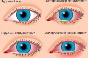 Як ефективно промивати очі, щоб усунути закисання: поради та засоби