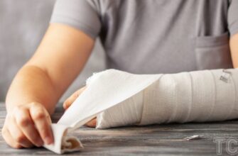 Як ефективно розробити руку після перелому зап’ястя: поради та вправи