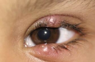 Як ефективно вивести аскариди з організму після лікування: поради та етапи