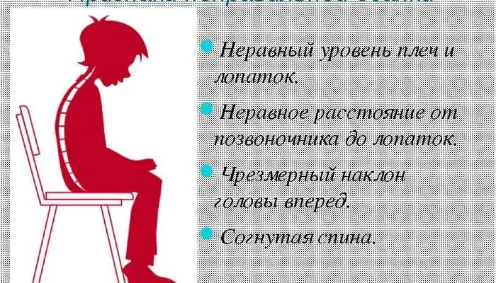 Як ефективно зменшити біль при шийному остеохондрозі: дієві методи