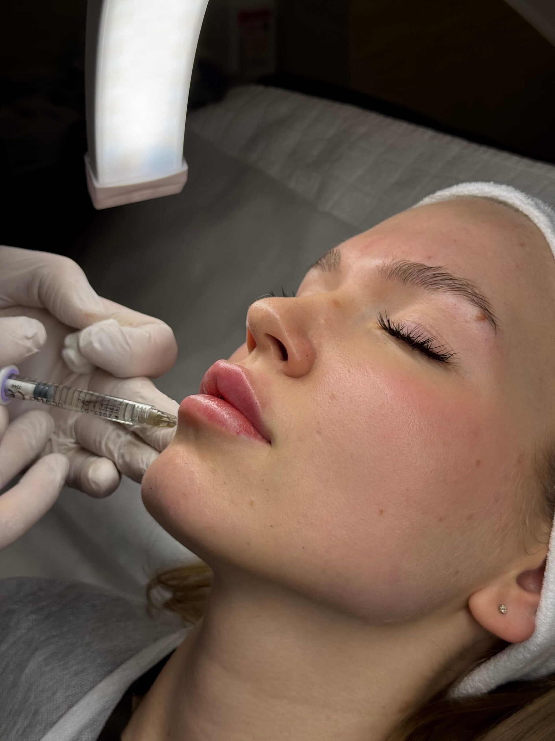 У Запоріжжі дівчині, після збільшення губ, знадобилось лікування ...