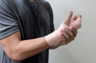 Як ефективно зняти набряк після зняття гіпсу: корисні поради та методи