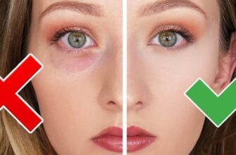 Як ефективно зняти набряки під очима: найкращі методи та поради