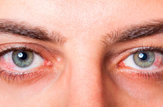 Як ефективно зняти набряки під очима вдома: кращі методи та поради