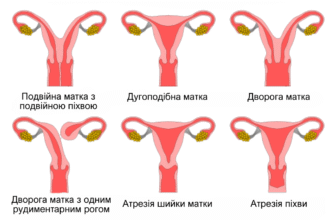 Як ефективно зняти тонус матки під час вагітності: поради та методи