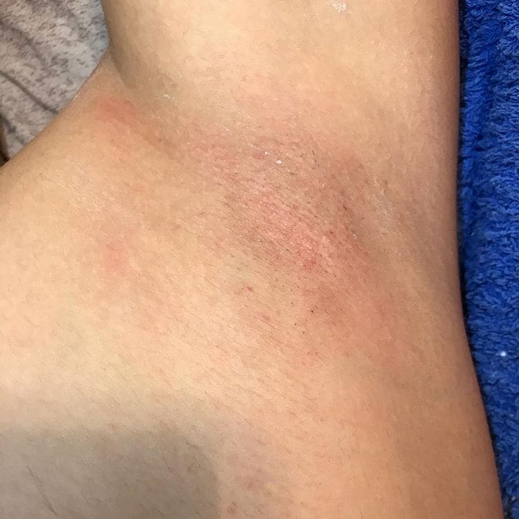 Воскова епіляція у Львові за низькою ціною - салон краси