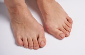 Як ефективно зняти запалення кісточки на нозі: практичні поради
