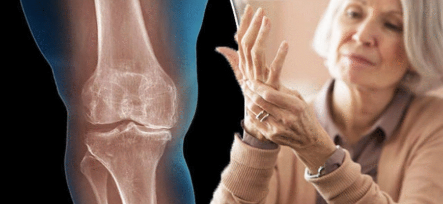 Як ефективно зняти запалення суглобів: поради та методики лікування