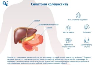 Як ефективно зняти запалення жовчного міхура: поради та методи