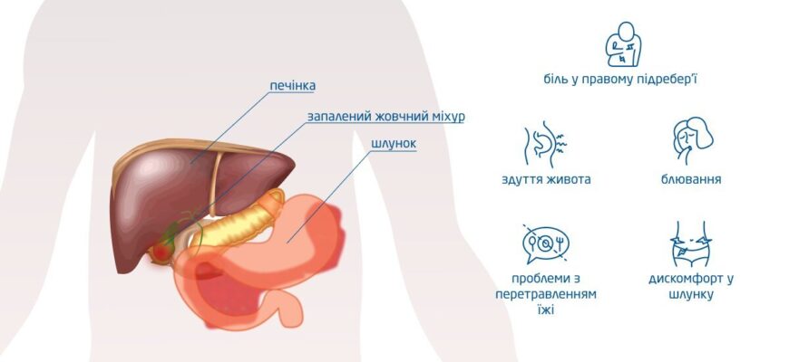 Як ефективно зняти запалення жовчного міхура: поради та методи