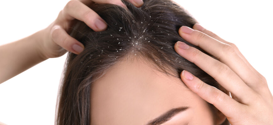 Як ефективно зняти зуд шкіри голови: поради та засоби для полегшення