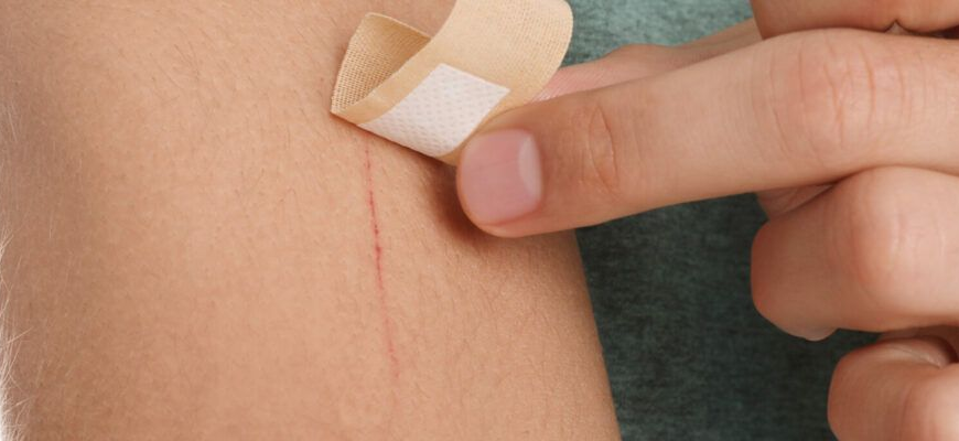 Як легко і швидко зняти самоклеючу плівку: практичні поради