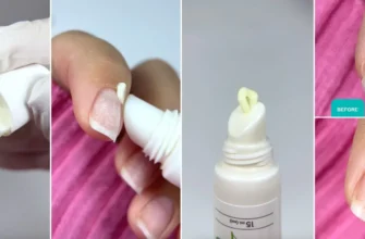 Як лікувати м’які нігті: ефективні методи та засоби для зміцнення