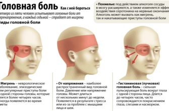 Як полегшити головний біль при шийному остеохондрозі: поради та лікування