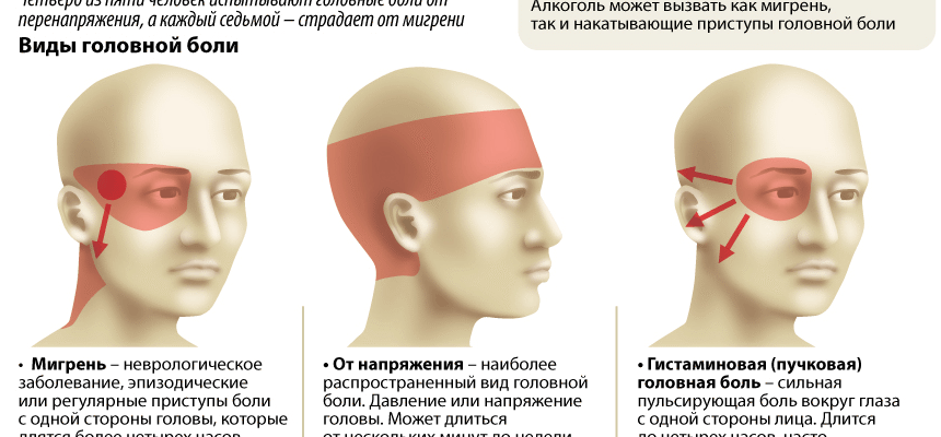 Як полегшити головний біль при шийному остеохондрозі: поради та лікування