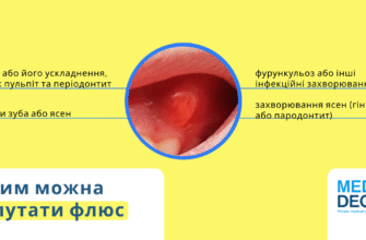 Як полоскати зуб при флюсі: ефективні розчини для швидкого полегшення