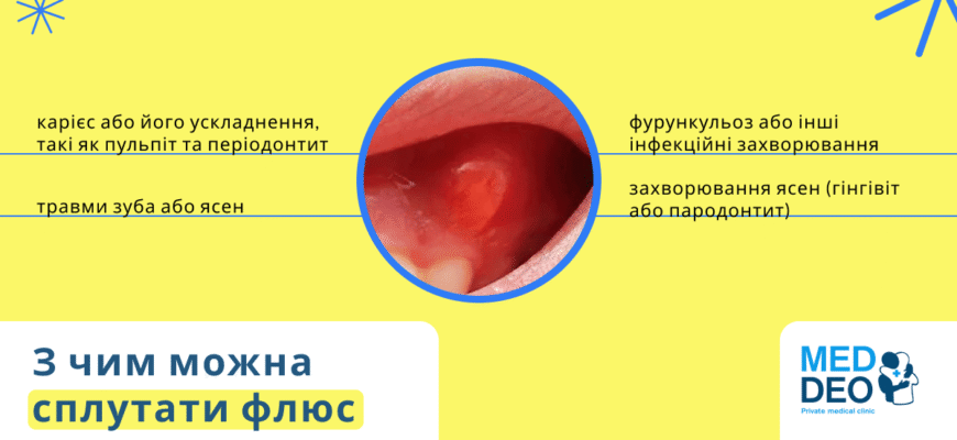 Як полоскати зуб при флюсі: ефективні розчини для швидкого полегшення