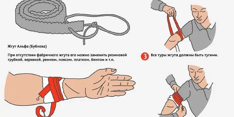 Як правильно накладати джгут для ефективної зупинки кровотечі