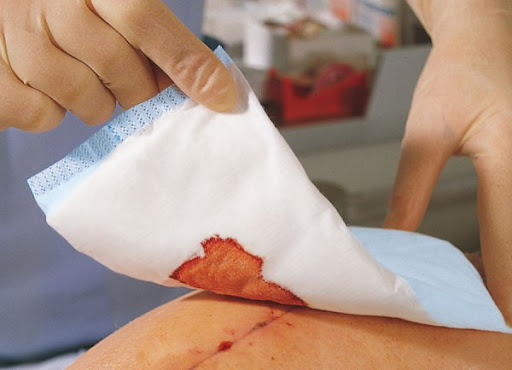 5 способів правильно зробити перев'язку