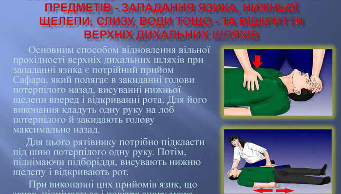 Як правильно виконати штучне дихання: що потрібно знати для успіху