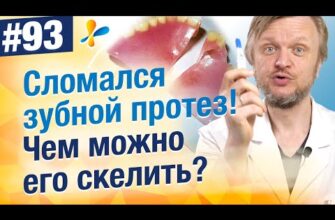 Як приклеїти зубний міст в домашніх умовах: практичні поради