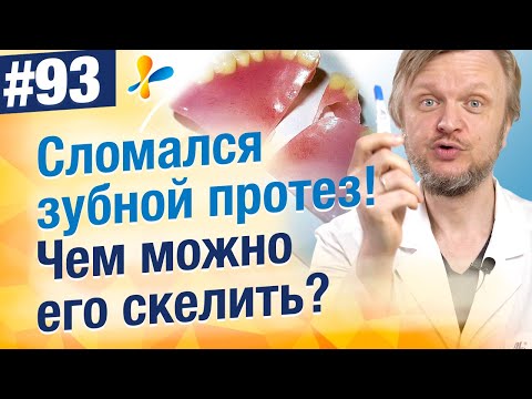 Як приклеїти зубний міст в домашніх умовах: практичні поради