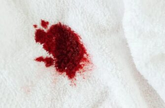 Як швидко та ефективно вивести плями крові: поради та засоби