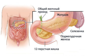 Як швидко та ефективно зняти біль у підшлунковій залозі: поради