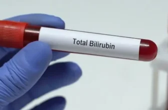 Як швидко та ефективно зняти спазм жовчного міхура в домашніх умовах