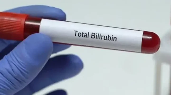 Як швидко та ефективно зняти спазм жовчного міхура в домашніх умовах