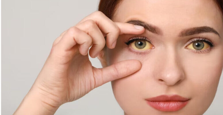 Як швидко зняти алергічний набряк з очей: ефективні методи та поради