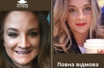 Як швидко зняти набряк обличчя після вживання алкоголю: дієві методи